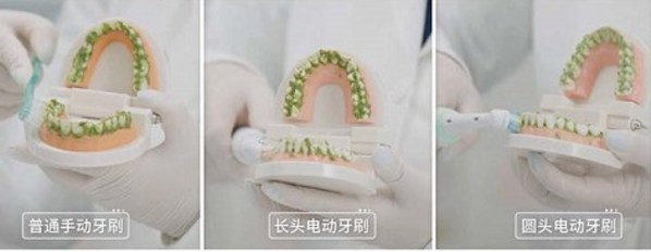 清潔力對(duì)比：普通手動(dòng)牙刷、長(zhǎng)頭電動(dòng)牙刷及圓頭電動(dòng)牙刷