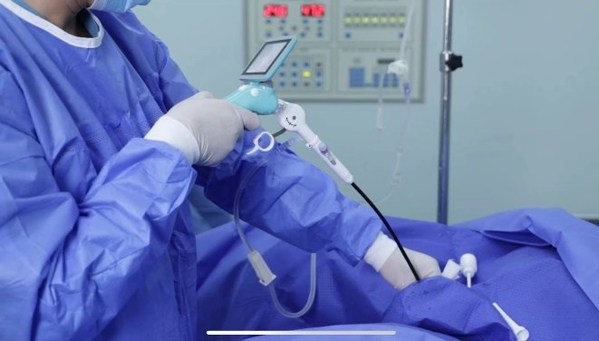 博鰲首例一次性電子膀胱鏡落地，膀胱腫瘤檢查迎來新選擇