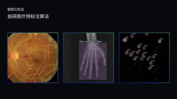 澳鵬MediGo平臺集成醫(yī)療專用NER模型、問答對自動生成系統(tǒng)和自研預(yù)標(biāo)注算法